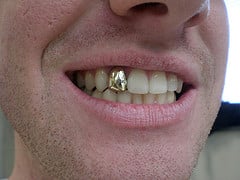 Name:  gold-tooth.jpg  Views: 70  Size:  16.3 KB