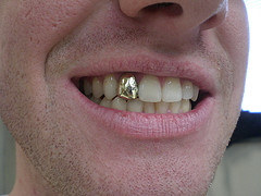Today [5]-gold-tooth.jpg