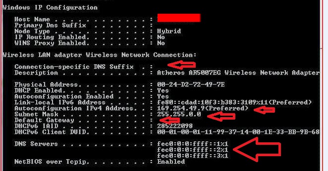 Laptop 'suddenly' lost network, IPconfig...-ipconfig_2.jpg