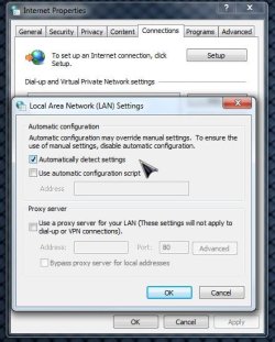 IE Settings Automatically Detect.jpg