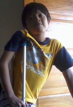 Kevin with crutches.jpg Kevin with crutches.jpg