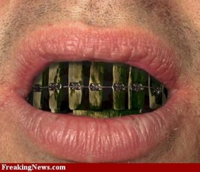 Rotten-Teeth--27759.jpg Rotten-Teeth--27759.jpg