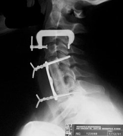 Neck.jpg Neck.jpg