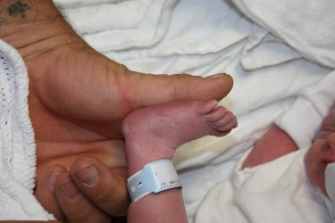 Crewe foot & dads thumb small.jpg