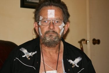 patches face 1.JPG