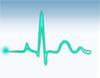 Heart_EKG-Beat.gif
