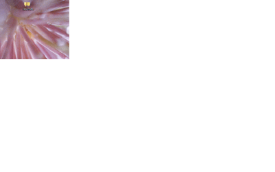 Glitch2.png Glitch2.png