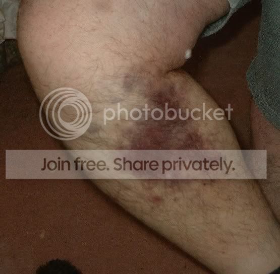leg.jpg